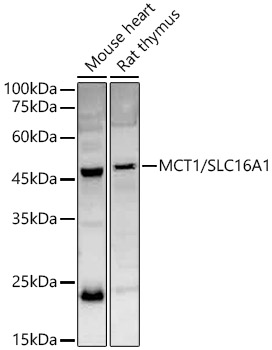 Western blot analysis of extracts of various cell lines using MCT1/SLC16A1 Polyclonal Antibody at 1:2000 dilution.