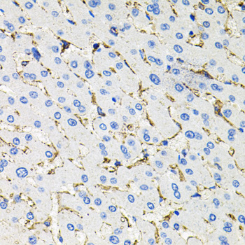 Immunohistochemistry of paraffin-embedded human liver damage using Somatostatin Receptor 2 (SSTR2) Polyclonal antibody at dilution of 1:100 (40x lens).Perform microwave antigen retrieval with 10 mM PBS buffer pH 7.2 before commencing with IHC staining protocol.