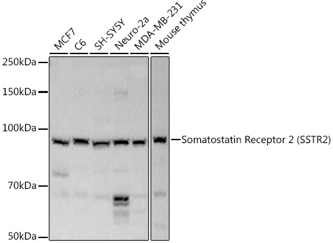 Western blot analysis of extracts of various cell lines using Somatostatin Receptor 2 (SSTR2)  Polyclonal Antibody at 1:1000 dilution.