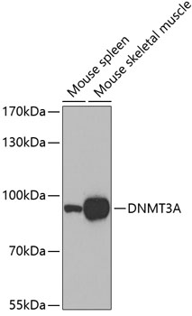 Western blot analysis of extracts of various cell lines using DNMT3A Polyclonal Antibody