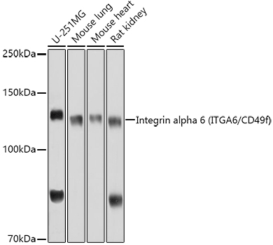 Western blot analysis of extracts of various cell lines using Integrin alpha 6 (ITGA6/CD49f) Polyclonal Antibody at 1:1000 dilution.