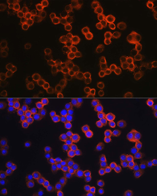 Immunofluorescence analysis of RAW264.7 cells using TLR4 Polyclonal Antibody at dilution of 1:250 (40x lens).Blue: DAPI for nuclear staining.