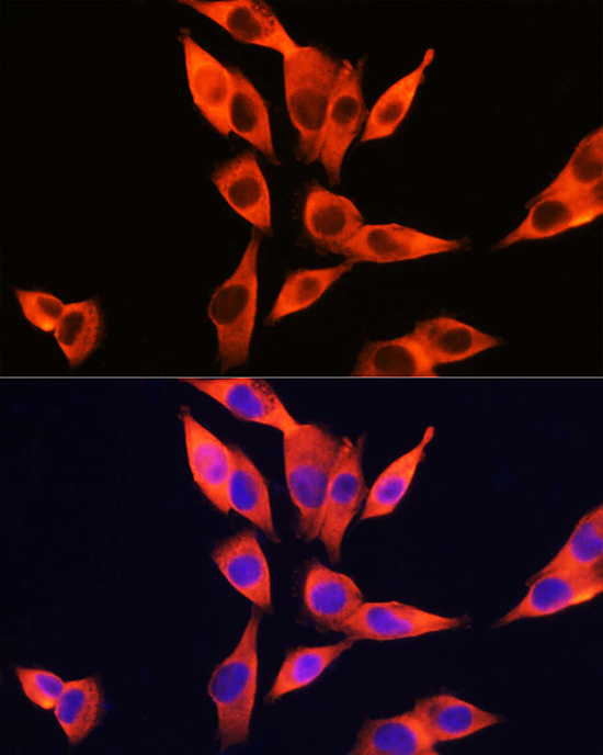 Immunofluorescence analysis of HepG2 cells using TLR4 Polyclonal antibody at dilution of 1:250 (40x lens).Blue: DAPI for nuclear staining.