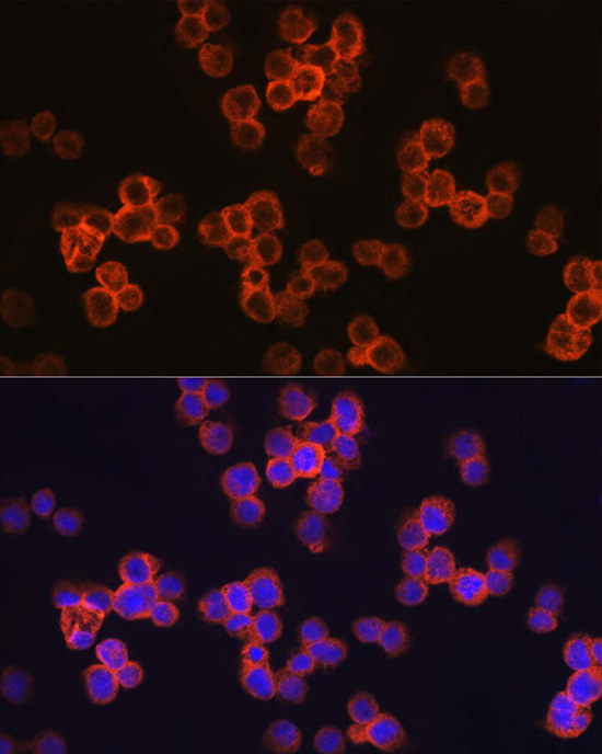 Immunofluorescence analysis of THP-1 cells using TLR4 Polyclonal antibody at dilution of 1:250 (40x lens).Blue: DAPI for nuclear staining.