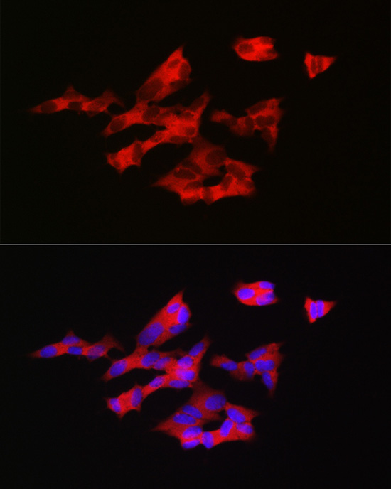 Immunofluorescence analysis of SH-SY5Y cells using GNRH1 Polyclonal antibody at dilution of 1:200 (40x lens). Blue: DAPI for nuclear staining.