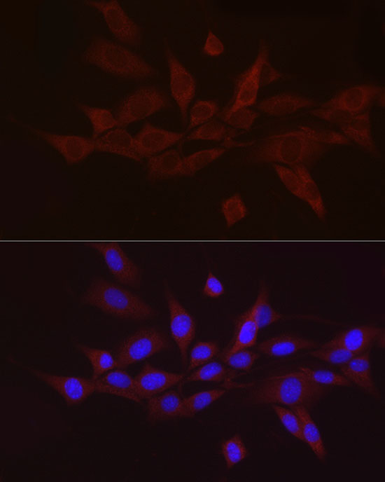 Immunofluorescence analysis of NIH/3T3 cells using GNRH1 Polyclonal antibody at dilution of 1:50 (40x lens). Blue: DAPI for nuclear staining.