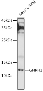 Western blot analysis of extracts of Mouse lung using GNRH1 Polyclonal Antibody at 1:1000 dilution.