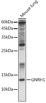 Western blot analysis of extracts of Rat kidney using GNRH1 Polyclonal Antibody at 1:1000 dilution.