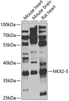 Western blot analysis of extracts of various cell lines using NKX2-5 Polyclonal Antibody at 1:1000 dilution.