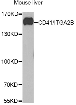 Western blot analysis of extracts of mouse liver using CD41/CD41/ITGA2B Polyclonal Antibody at 1:1000 dilution.