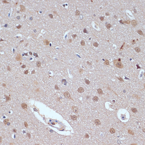 Immunohistochemistry of paraffin-embedded rat brain using TP53BP2 Polyclonal Antibody at dilution of 1:100 (40x lens).Perform microwave antigen retrieval with 10 mM PBS buffer pH 7.2 before commencing with IHC staining protocol.