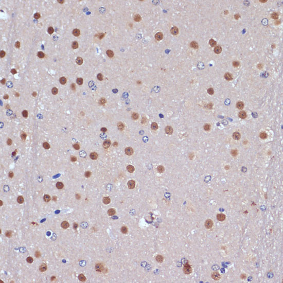 Immunohistochemistry of paraffin-embedded mouse brain using TP53BP2 Polyclonal antibody at dilution of 1:100 (40x lens).Perform microwave antigen retrieval with 10 mM PBS buffer pH 7.2 before commencing with IHC staining protocol.