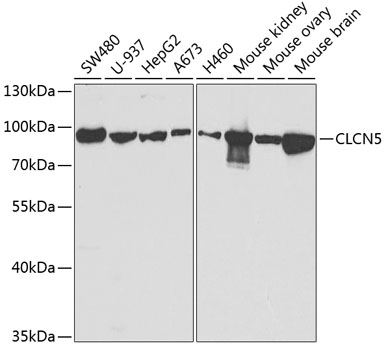 Western blot analysis of extracts of various cell lines using CLCN5 Polyclonal Antibody at 1:1000 dilution.