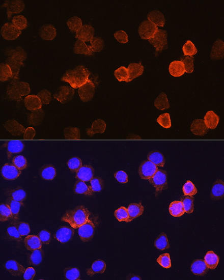 Immunofluorescence analysis of THP-1 cells using CD14 Polyclonal antibody at dilution of 1:100. Blue: DAPI for nuclear staining.