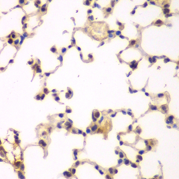 Immunohistochemistry of paraffin-embedded rat lung using NFKBIB Polyclonal Antibody at dilution of 1:200 (40x lens).Perform microwave antigen retrieval with 10 mM PBS buffer pH 7.2 before commencing with IHC staining protocol.