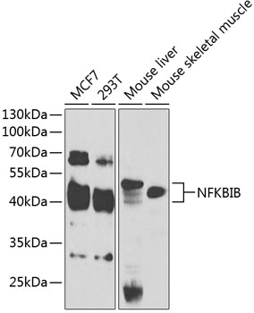 Western blot analysis of extracts of various cell lines using NFKBIB Polyclonal Antibody at 1:1000 dilution.