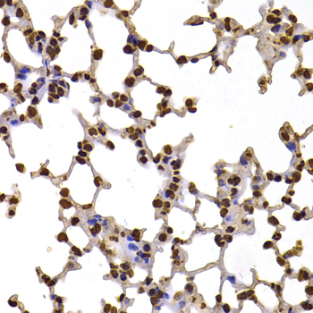 Immunohistochemistry of paraffin-embedded mouse lung using FBXW7 Polyclonal Antibody at dilution of 1:100 (40x lens).Perform microwave antigen retrieval with 10 mM PBS buffer pH 7.2 before commencing with IHC staining protocol.