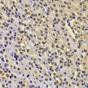 Immunohistochemistry of paraffin-embedded mouse kidney using FBXW7 Polyclonal antibody at dilution of 1:100 (40x lens).Perform microwave antigen retrieval with 10 mM PBS buffer pH 7.2 before commencing with IHC staining protocol.