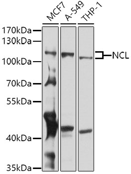 Western blot analysis of extracts of various cell lines using NCL Polyclonal Antibody at 1:1000 dilution.