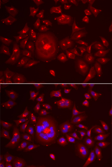 Immunofluorescence analysis of A549 cells using GRASP65 Polyclonal Antibody Blue: DAPI for nuclear staining.