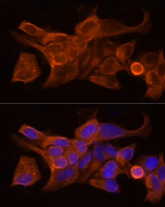 Immunofluorescence analysis of MCF7 cells using HE4/WFDC2 Polyclonal Antibody at dilution of 1:50 (40x lens). Blue: DAPI for nuclear staining.