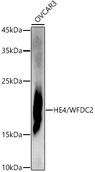 Western blot analysis of extracts of OVCAR3 cells using HE4/WFDC2  Polyclonal Antibody at 1:1000 dilution.