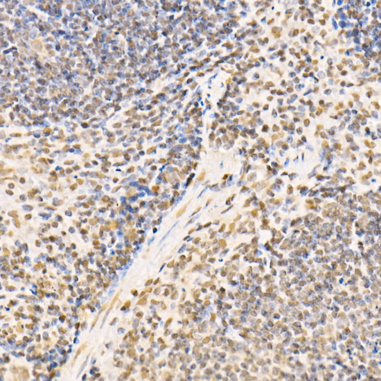 Immunohistochemistry of paraffin-embedded mouse spleen using SS18 Polyclonal antibody at dilution of 1:100 (40x lens).Perform high pressure antigen retrieval with 10 mM citrate buffer pH 6.0 before commencing with IHC staining protocol.