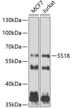 Western blot analysis of extracts of various cell lines using SS18 Polyclonal Antibody at 1:1000 dilution.