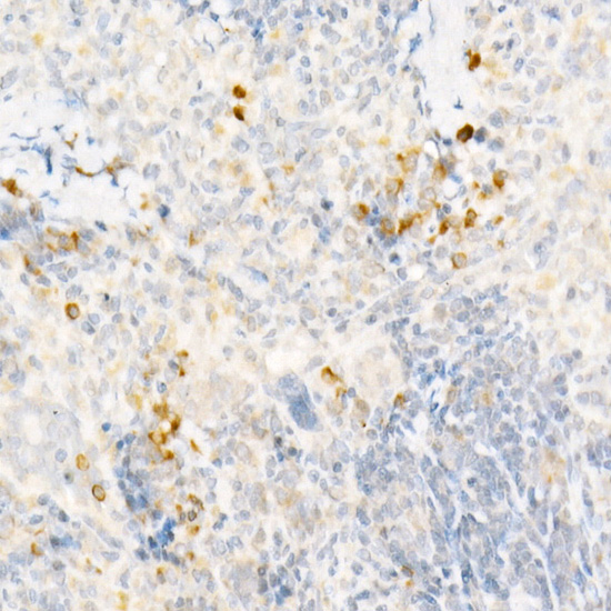 Immunohistochemistry of paraffin-embedded Rat spleen using CCL2/MCP-1 Polyclonal antibody at dilution of 1:50 (40x lens).Perform high pressure antigen retrieval with 10 mM citrate buffer pH 6.0 before commencing with IHC staining protocol.