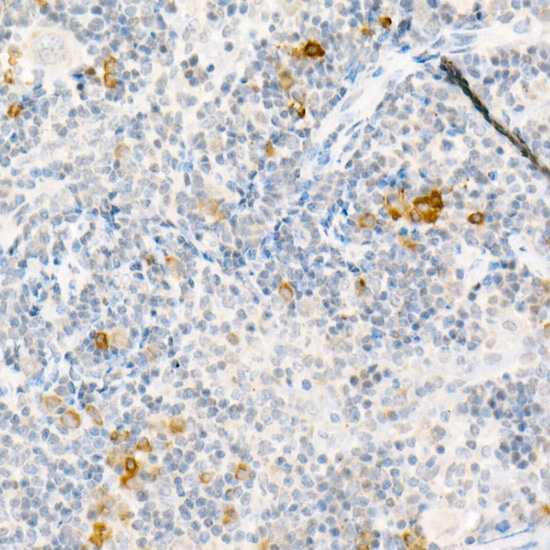 Immunohistochemistry of paraffin-embedded Mouse spleen using CCL2/MCP-1 Polyclonal antibody at dilution of 1:50 (40x lens).Perform high pressure antigen retrieval with 10 mM citrate buffer pH 6.0 before commencing with IHC staining protocol.