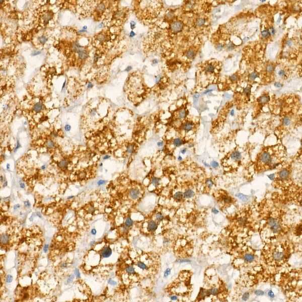 Immunohistochemistry of paraffin-embedded human liver using COX1 Polyclonal Antibody at dilution of 1:25 (40x lens).Perform high pressure antigen retrieval with 10 mM citrate buffer pH 6.0 before commencing with IHC staining protocol.