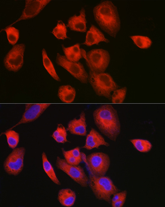 Immunofluorescence analysis of RD cells using MYH7/β-MHC Polyclonal Antibody at dilution of 1:150 (40x lens). Blue: DAPI for nuclear staining.