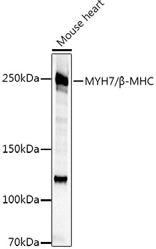 Western blot analysis of extracts of various cell lines using MYH7/β-MHC Polyclonal Antibody at 1:500 dilution.