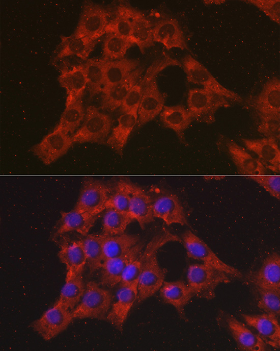 Immunofluorescence analysis of C6 cells using CCL3 Polyclonal Antibody at dilution of 1:100 (40x lens). Blue: DAPI for nuclear staining.