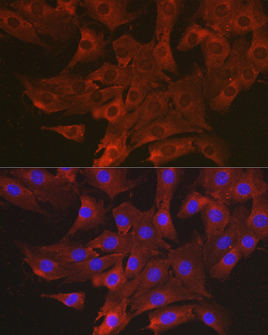 Immunofluorescence analysis of NIH-3T3 cells using CCL3 Polyclonal antibody at dilution of 1:100 (40x lens). Blue: DAPI for nuclear staining.