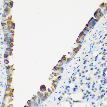 Immunohistochemistry of paraffin-embedded mouse lung using TNNC2 Polyclonal antibody at dilution of 1:200 (40x lens).Perform microwave antigen retrieval with 10 mM PBS buffer pH 7.2 before commencing with IHC staining protocol.