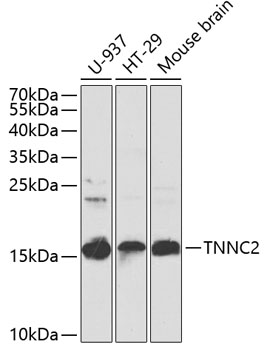 Western blot analysis of extracts of various cell lines using TNNC2 Polyclonal Antibody at 1:1000 dilution.