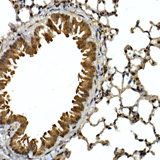 Immunohistochemistry of paraffin-embedded mouse lung using SQSTM1/p62 Polyclonal antibody at dilution of 1:100 (40x lens).Perform high pressure antigen retrieval with 10 mM citrate buffer pH 6.0 before commencing with IHC staining protocol.