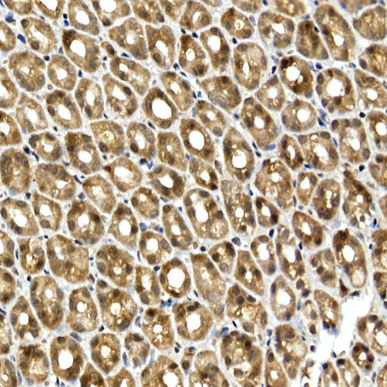 Immunohistochemistry of paraffin-embedded rat stomach using SQSTM1/p62 Polyclonal antibody at dilution of 1:100 (40x lens).Perform high pressure antigen retrieval with 10 mM citrate buffer pH 6.0 before commencing with IHC staining protocol.