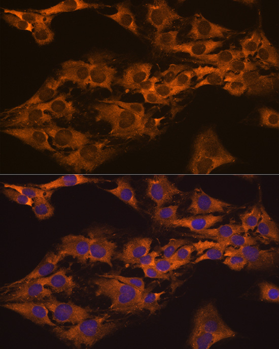 Immunofluorescence analysis of C6 cells using CAPRIN1 Polyclonal antibody at dilution of 1:100 (40x lens). Blue: DAPI for nuclear staining.