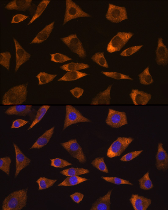 Immunofluorescence analysis of L929 cells using CAPRIN1 Polyclonal antibody at dilution of 1:100 (40x lens). Blue: DAPI for nuclear staining.