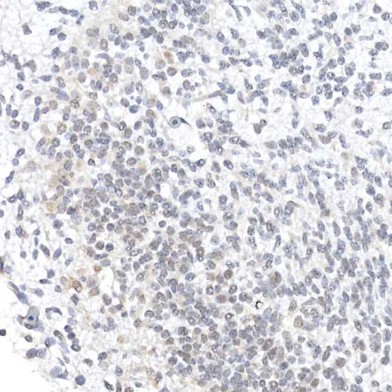 Immunohistochemistry of paraffin-embedded mouse fetal Brain using OCT4 Polyclonal Antibody at dilution of 1:50 (40x lens).Perform high pressure antigen retrieval with 10 mM citrate buffer pH 6.0 before commencing with IHC staining protocol.