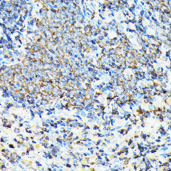 Immunohistochemistry of paraffin-embedded mouse spleen using CORO1A Polyclonal antibody at dilution of 1:100 (40x lens).Perform high pressure antigen retrieval with 10 mM citrate buffer pH 6.0 before commencing with IHC staining protocol.