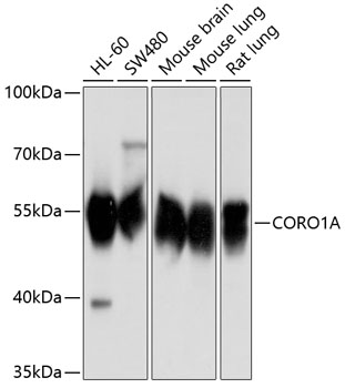 Western blot analysis of extracts of various cell lines using CORO1A Polyclonal Antibody at 1:1000 dilution.