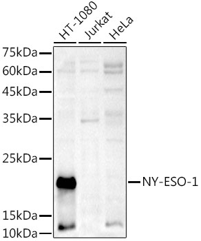 Western blot analysis of extracts of various cell lines using NY-ESO-1  Polyclonal Antibody at 1:1000 dilution.