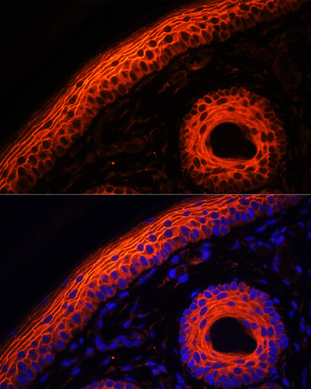 Immunofluorescence analysis of rat skin using DSG1 Polyclonal Antibody at dilution of 1:100. Blue: DAPI for nuclear staining.