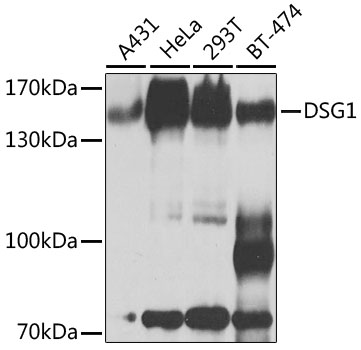 Western blot analysis of extracts of various cell lines using DSG1 Polyclonal Antibody at 1:1000 dilution.