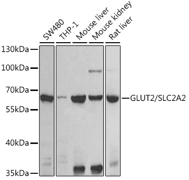 Western blot analysis of various lysates using GLUT2/SLC2A2 Polyclonal Antibody at 1:500 dilution.