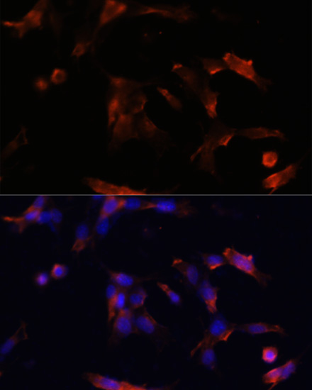 Immunofluorescence analysis of NIH/3T3 cells using AQP5 Polyclonal Antibody at dilution of 1:100. Blue: DAPI for nuclear staining.