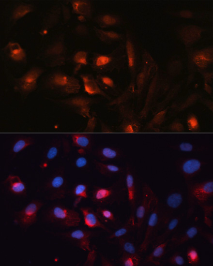 Immunofluorescence analysis of U2OS cells using AQP5 Polyclonal antibody at dilution of 1:100. Blue: DAPI for nuclear staining.